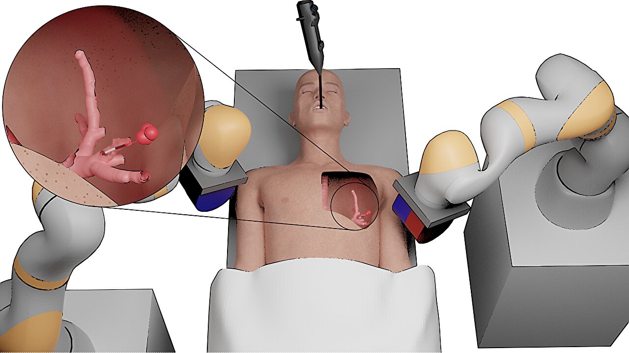 VIDEO. Cancerul pulmonar, tratat de un mini robot. Cum arată dispozitivul dezvoltat de cercetătorii de la Universitatea din Leeds