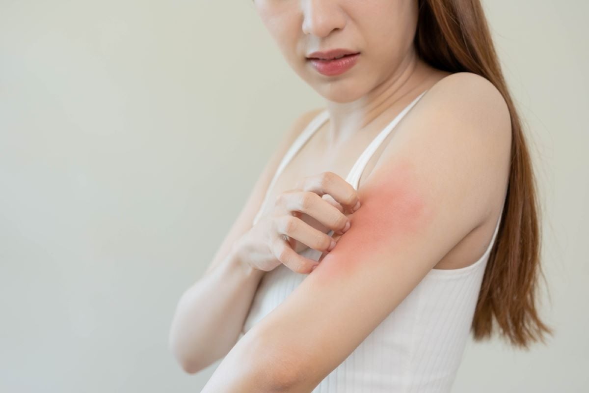 Remedii Eficiente Pentru Alergia La Soare- Ce Este Alergia La Soare