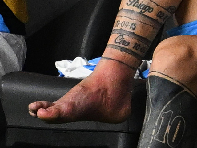 ”Covârșitor”. Cum a arătat glezna lui Lionel Messi, după accidentarea suferită în finala Copa America