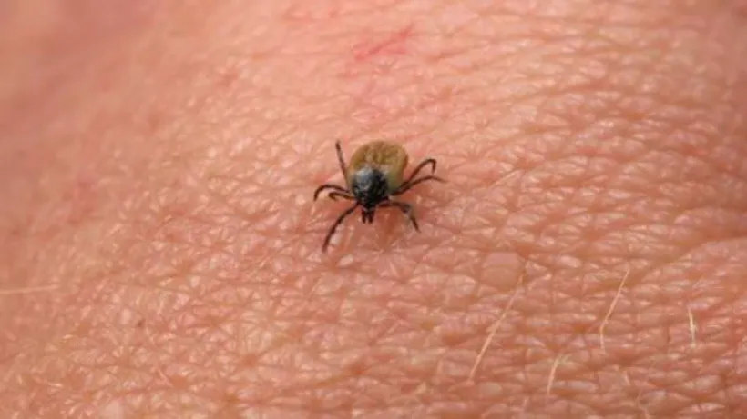 Invazie de CĂPUȘE în zonele verzi. Medic:”Pot transmite boala Lyme”