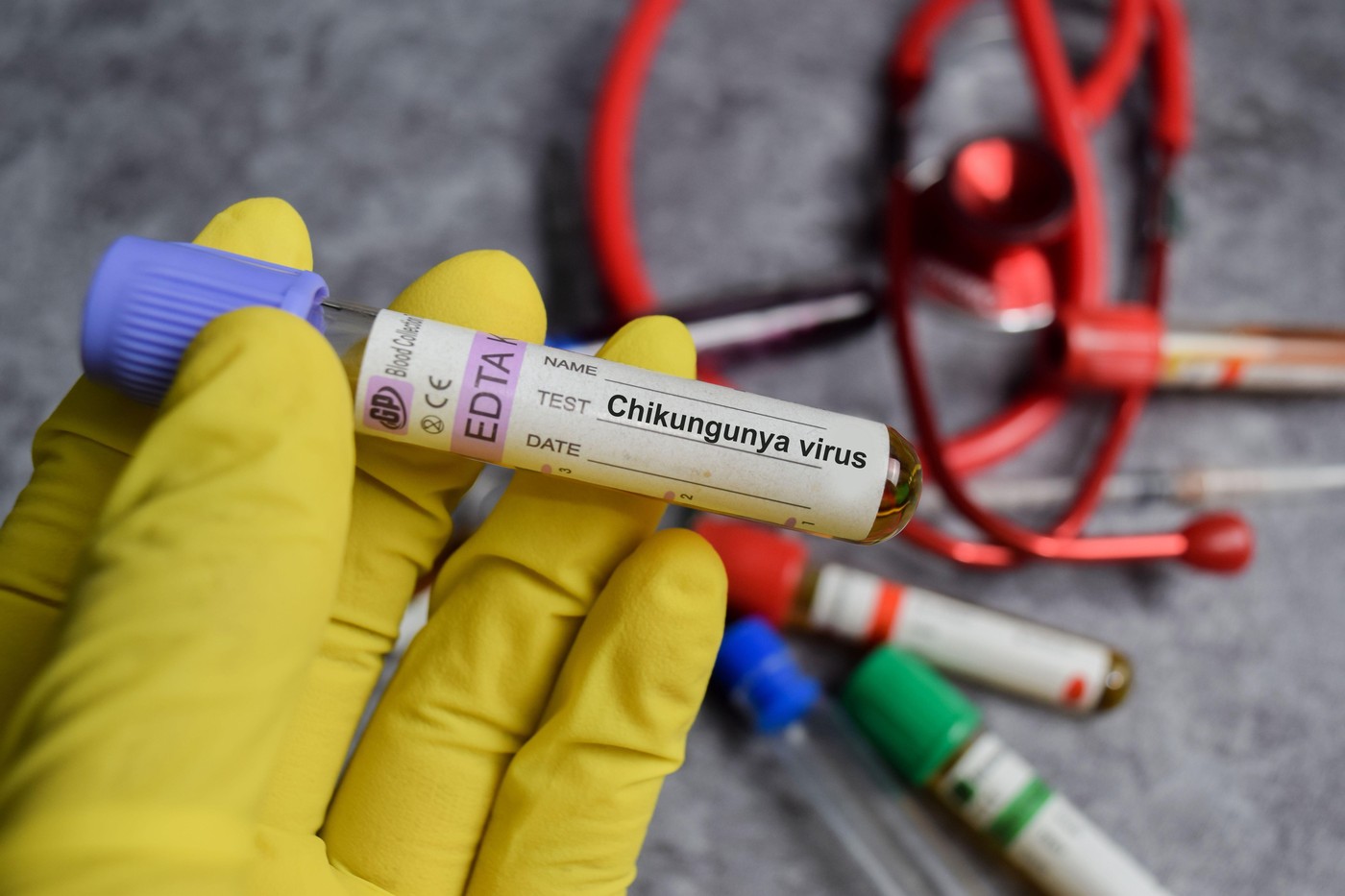 Alertă sanitară în New York. Prezența unui nou virus a fost confirmată de autorități. Cum se transmite și care sunt simptomele