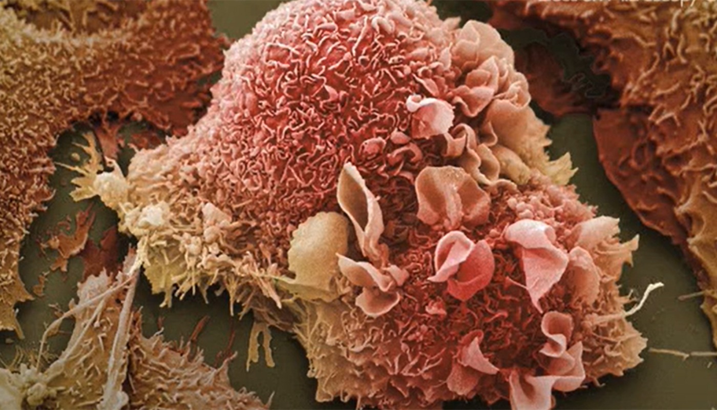 bacterii care distrug cancerul, fără să implice sistemul imunitar