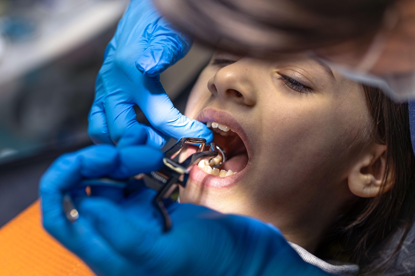 România, codașa Europei la igiena DENTARĂ. Dinți scoși acasă cu patentul, nu la cabinet. De ce ajung românii să se trateze cu leacuri băbești