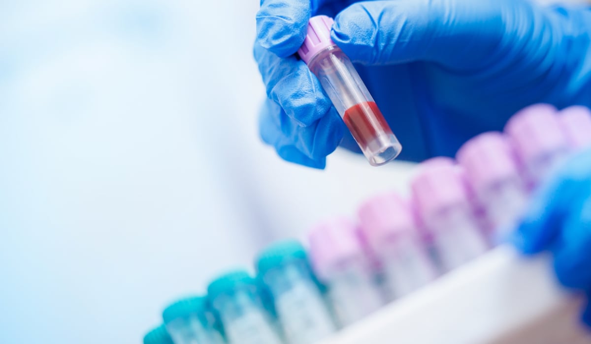 Metoda prin care ar putea fi prezis riscul de a dezvolta cancer