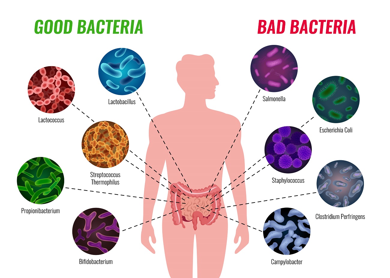 Infecția cu Clostridium difficile: Ce trebuie să știe fiecare român despre această boală insidioasă