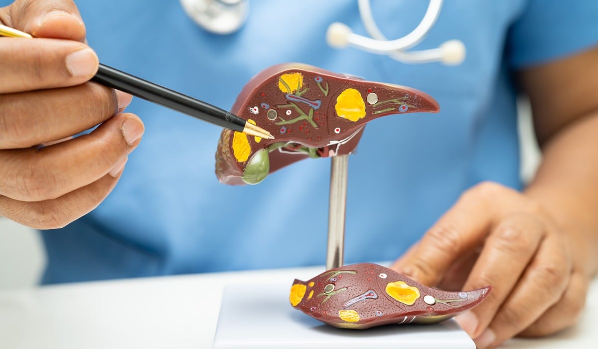 Ficatul gras îmbolnăvește inima. Campania care explică de ce steatoza nu este un diagnostic banal