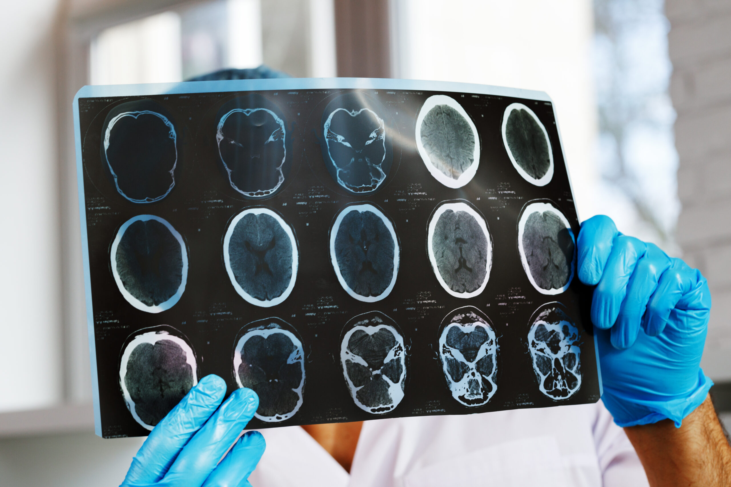 Neurologii vorbesc despre cel mai bun obicei pentru menținerea unei memorii bune după vârsta de 55 de ani. Ce ar trebui să faci zilnic