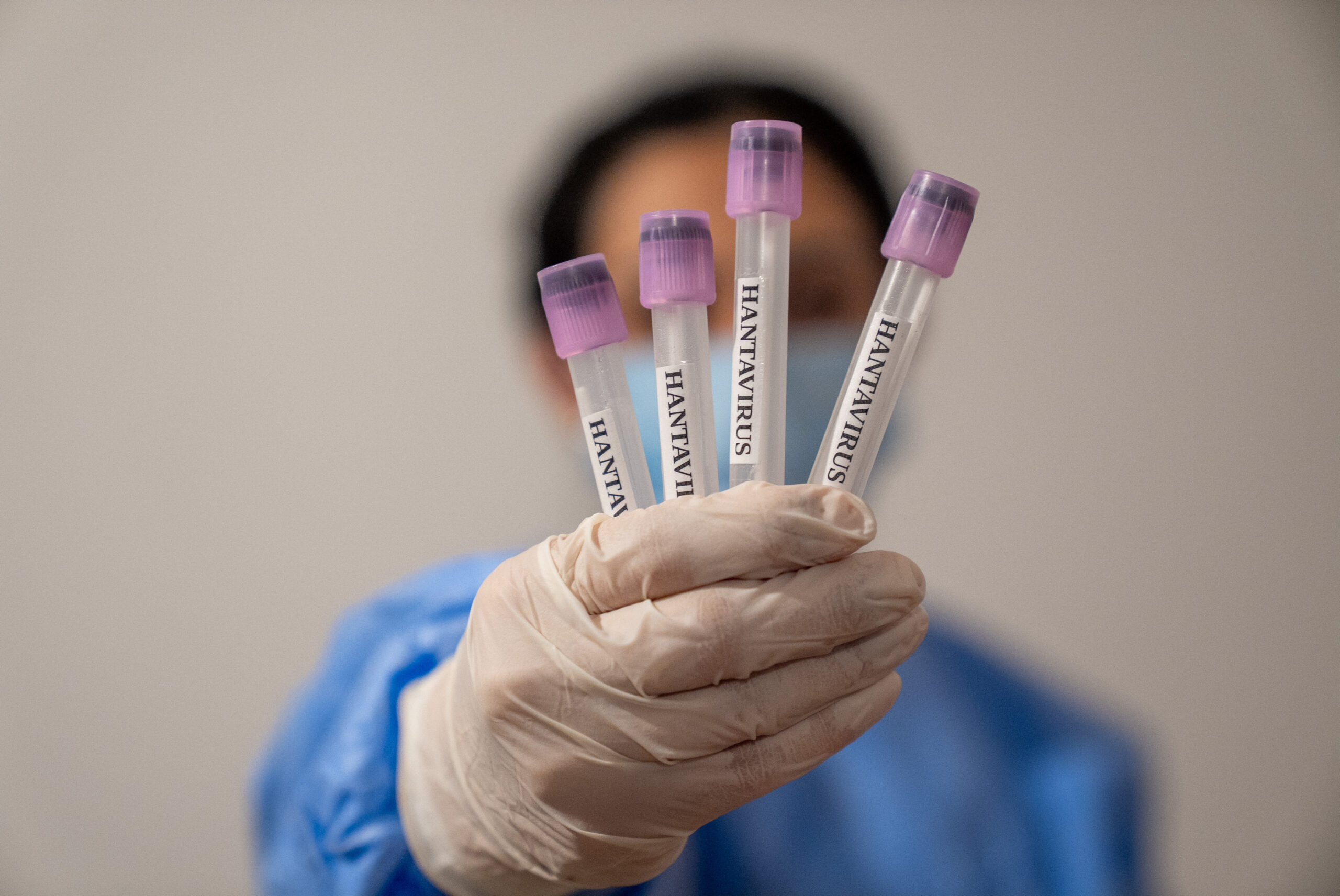 Panica provocată de hantavirus, nejustificată. OMS anunță că noul virus nu va provoca următoarea pandemie