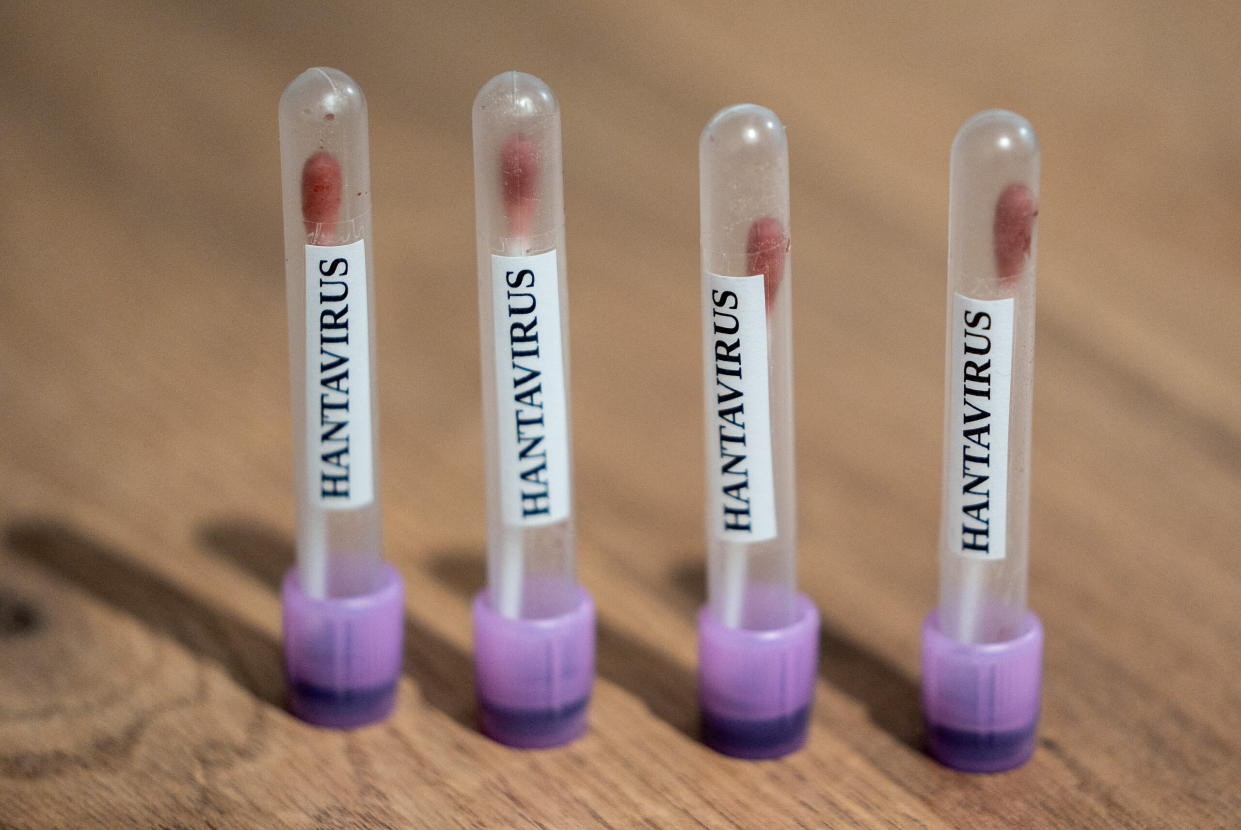 Pacientă infectată cu hantavirus, în stare gravă. Primește oxigen printr-un plămân artificial