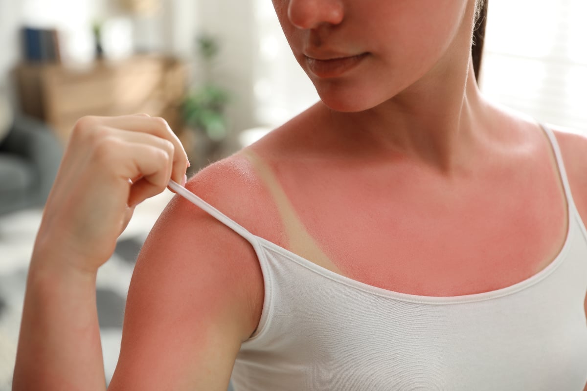 Greșeala banală de pe plajă care modifică ADN-ul pielii. Ce se întâmplă în corpul tău pe termen lung după o singură arsură solară